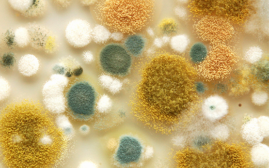 systemes-microbiens-denrees-alimentaires